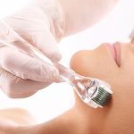 What Are the Benefits of Micro-Needling?
